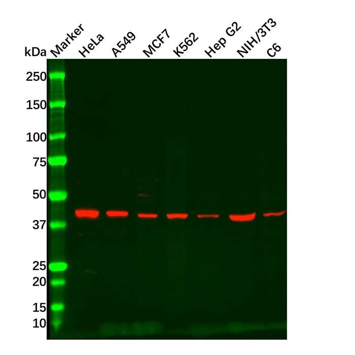 Recombinant ACADM/MCAD Antibody -    by Aladdin Scientific