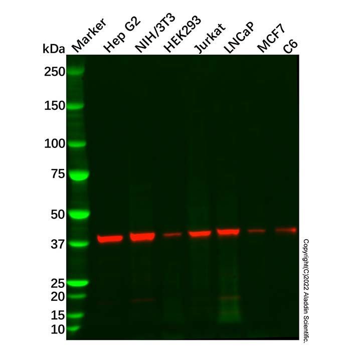 Recombinant ACADS/SCAD Antibody -    by Aladdin Scientific