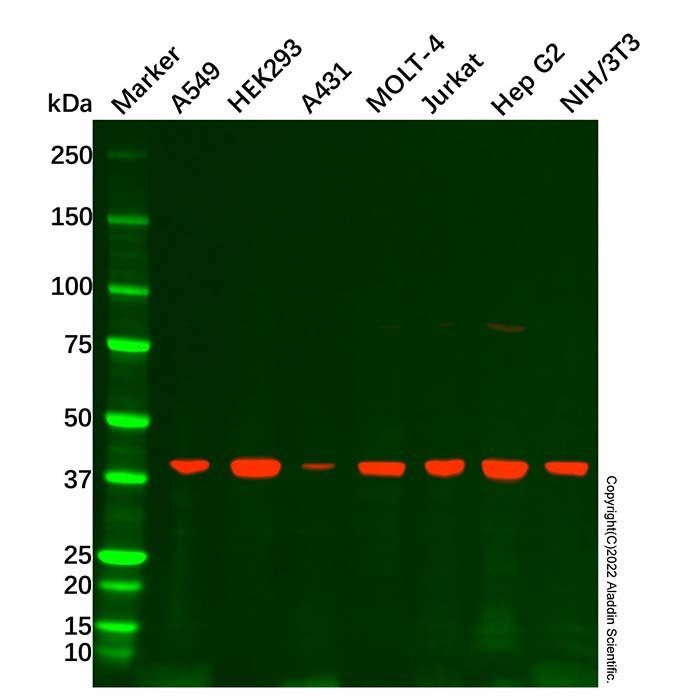 ACAT1 Antibody -    by Aladdin Scientific