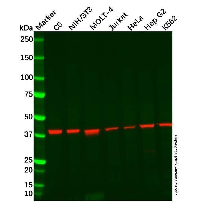 Recombinant ACAT2/Acetyl-CoA acetyltransferase Antibody -    by Aladdin Scientific