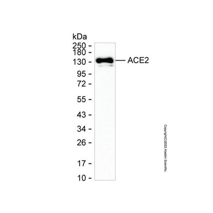ACE2 Mouse mAb -    by Aladdin Scientific
