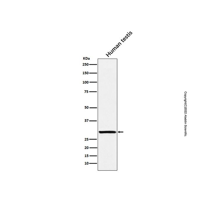 Recombinant ACRV1 Antibody -    by Aladdin Scientific