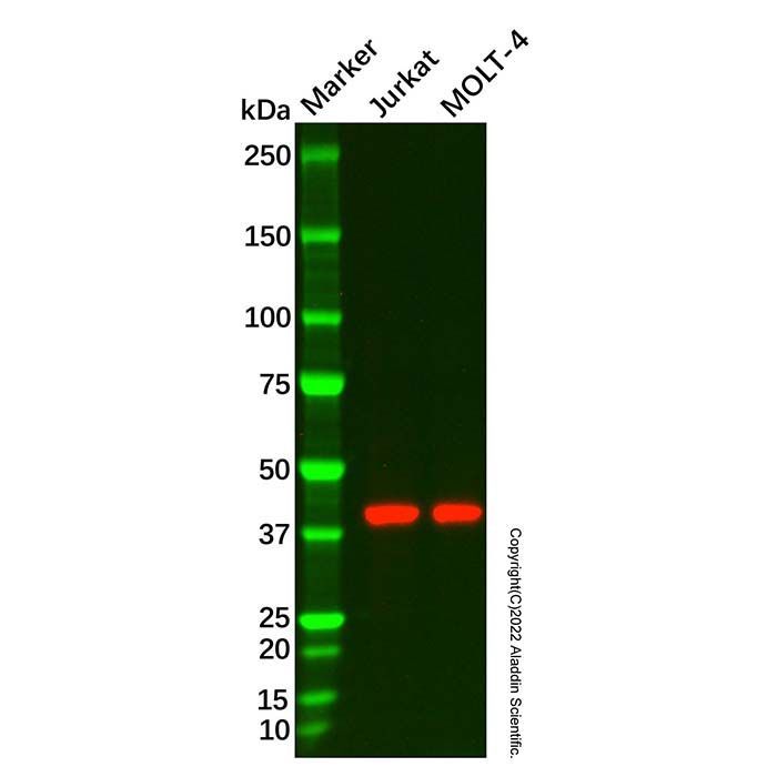 Recombinant ADA Antibody -    by Aladdin Scientific