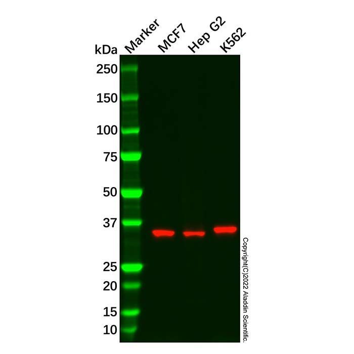 Recombinant ADH5 Antibody -    by Aladdin Scientific