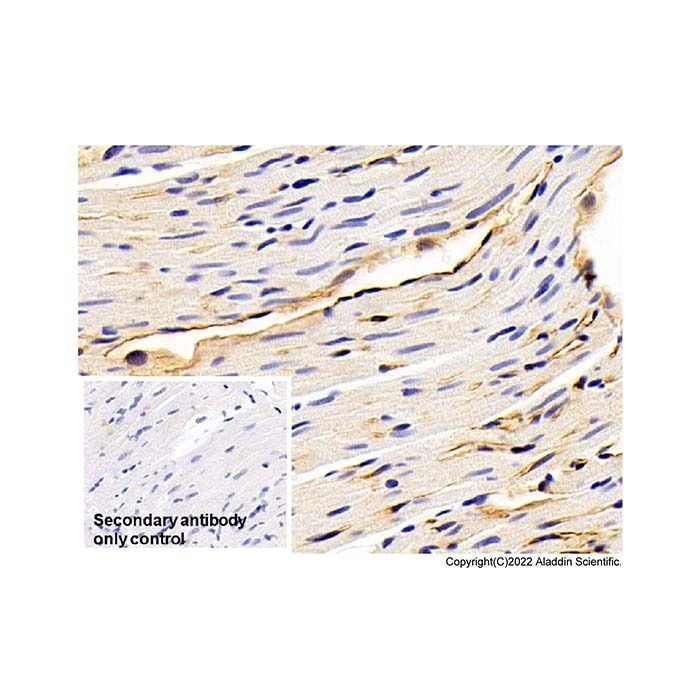 Adiponectin Mouse mAb -    by Aladdin Scientific