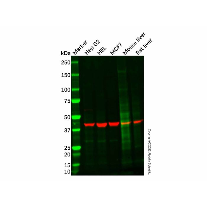 Adiponectin Receptor 2/ADIPOR2 Antibody -    by Aladdin Scientific
