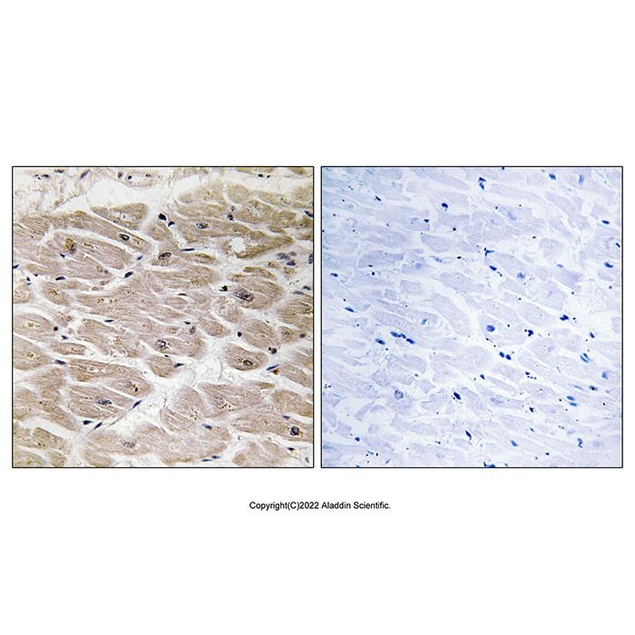 AGBL2 Antibody -    by Aladdin Scientific