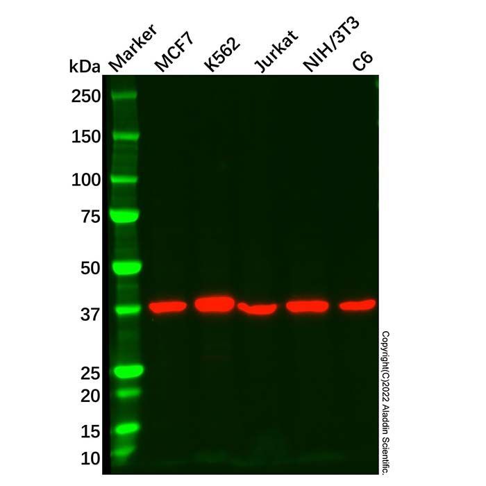 AIBZIP Mouse mAb -    by Aladdin Scientific