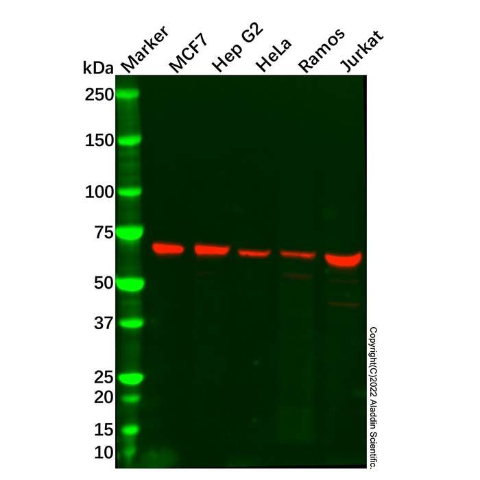 AIF Mouse mAb -    by Aladdin Scientific