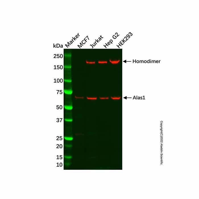 Recombinant Alas1 Antibody -    by Aladdin Scientific