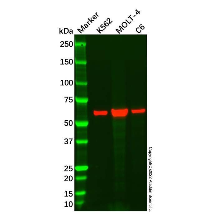 Recombinant ALAS2/ASB Antibody -    by Aladdin Scientific