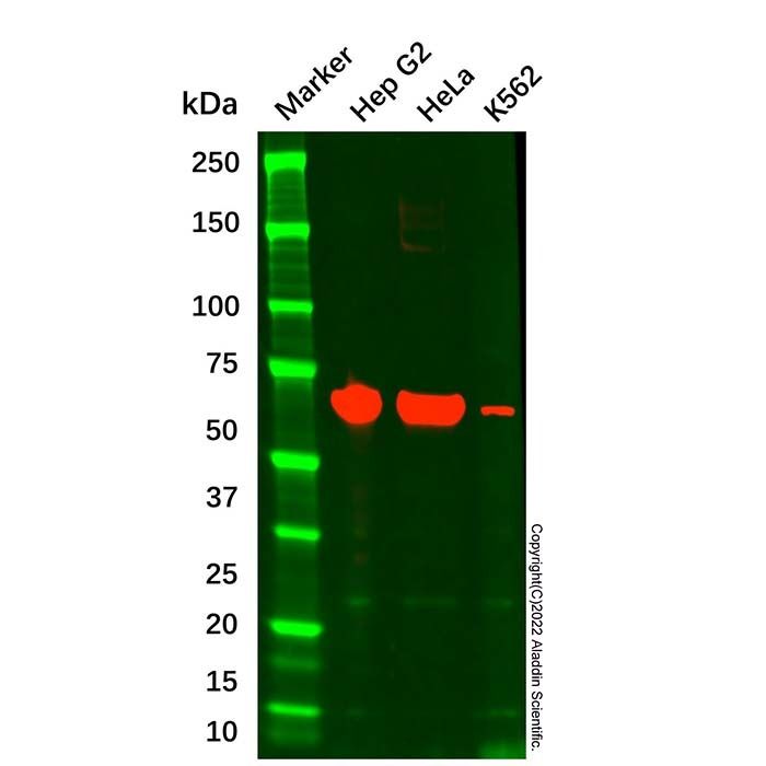Albumin Mouse mAb -    by Aladdin Scientific