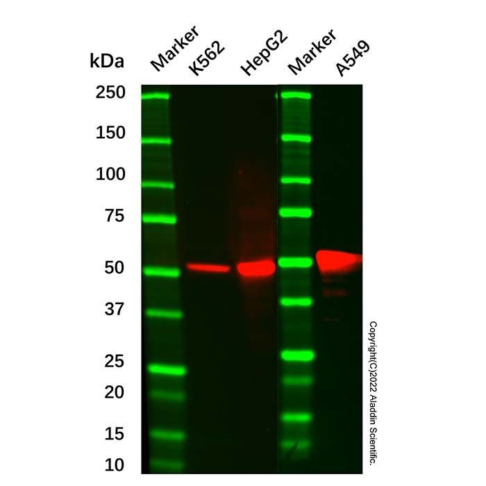ALDH1A1 Mouse mAb -    by Aladdin Scientific