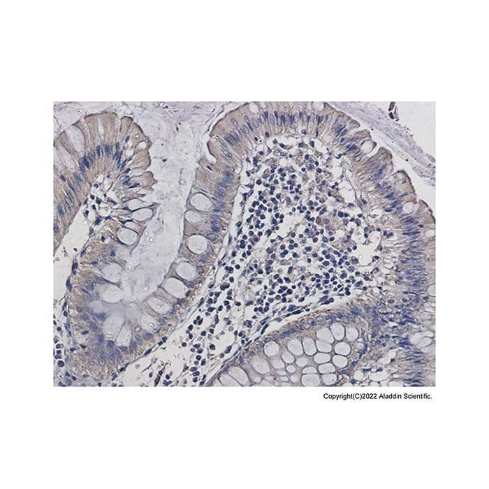 Recombinant ALDH2 Antibody -    by Aladdin Scientific