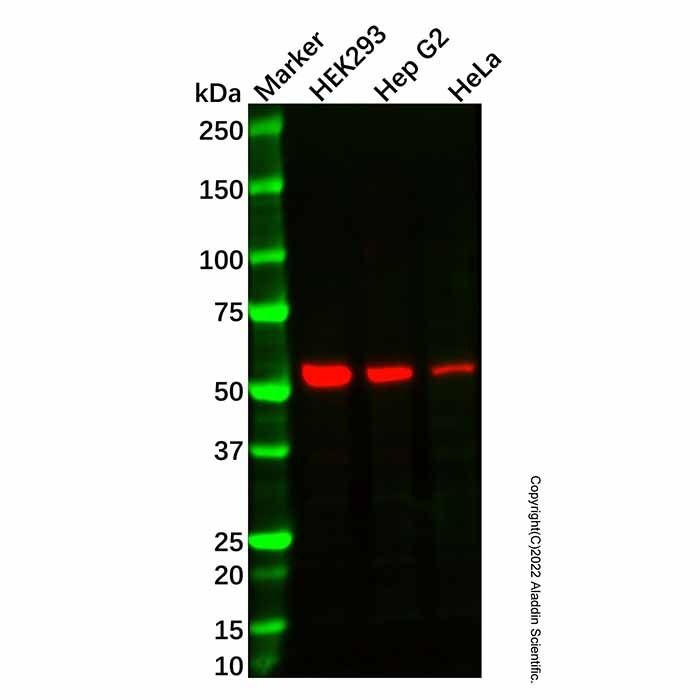Recombinant ALDH7A1 Antibody -    by Aladdin Scientific