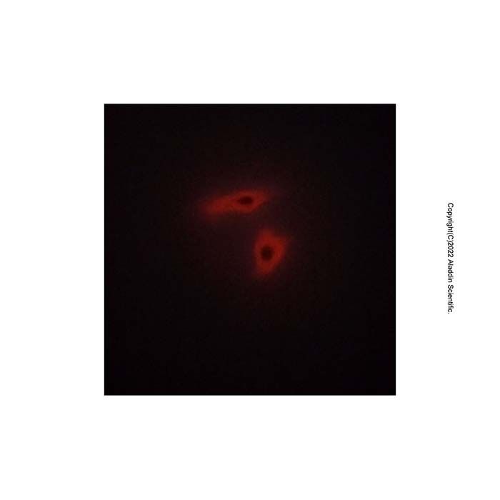 ALEX1 Antibody -    by Aladdin Scientific