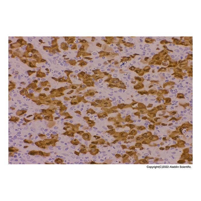 Recombinant ALK Antibody -    by Aladdin Scientific