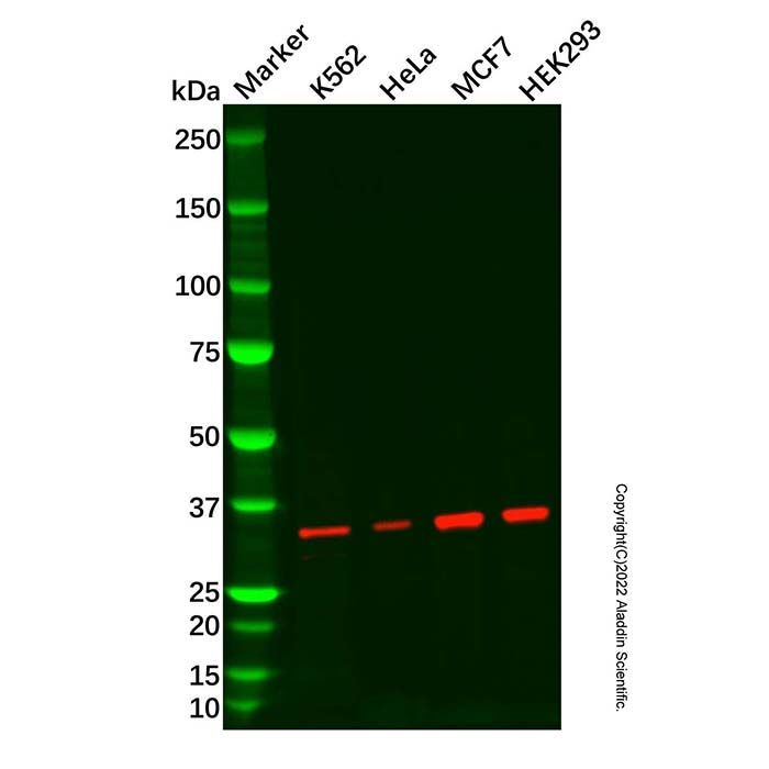 Recombinant ALKBH4 Antibody -    by Aladdin Scientific