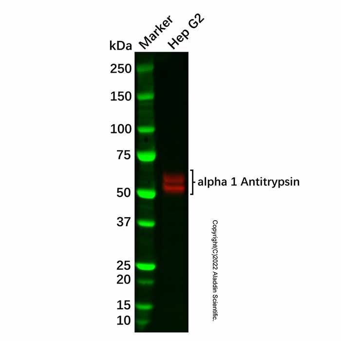 Recombinant alpha 1 Antitrypsin Antibody -    by Aladdin Scientific