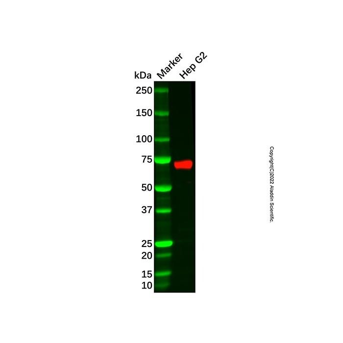 Recombinant alpha 1 Fetoprotein Antibody -    by Aladdin Scientific