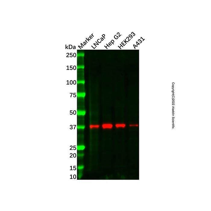 Recombinant ALS2CR1 Antibody -    by Aladdin Scientific
