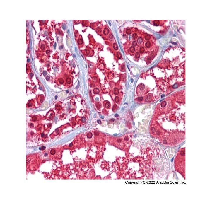 AMF Mouse mAb -    by Aladdin Scientific