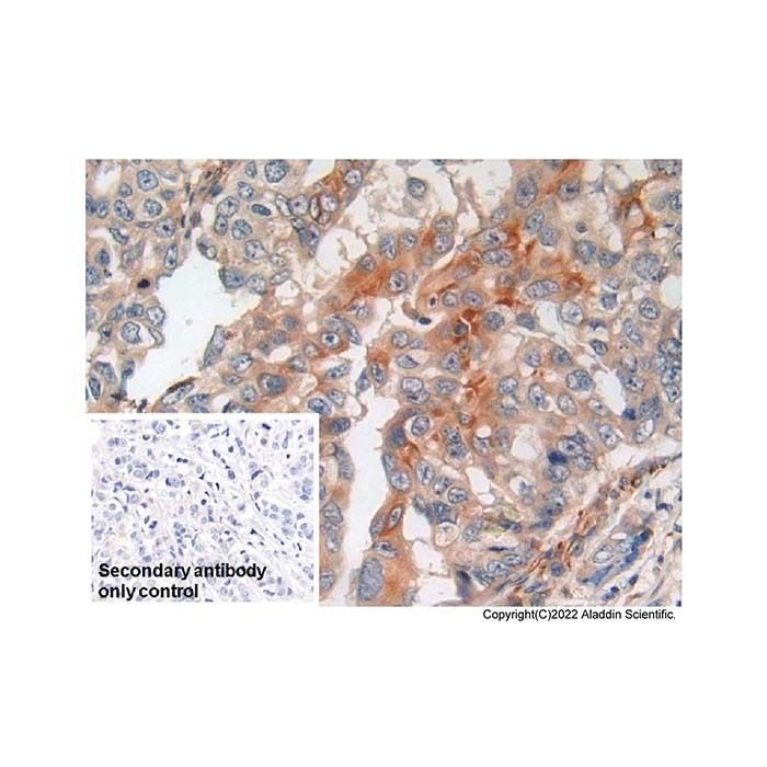Amphiregulin Mouse mAb - by Aladdin Scientific