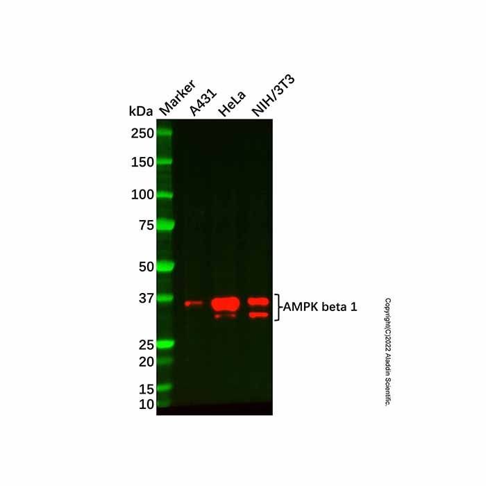 Recombinant AMPK beta 1 Antibody -    by Aladdin Scientific