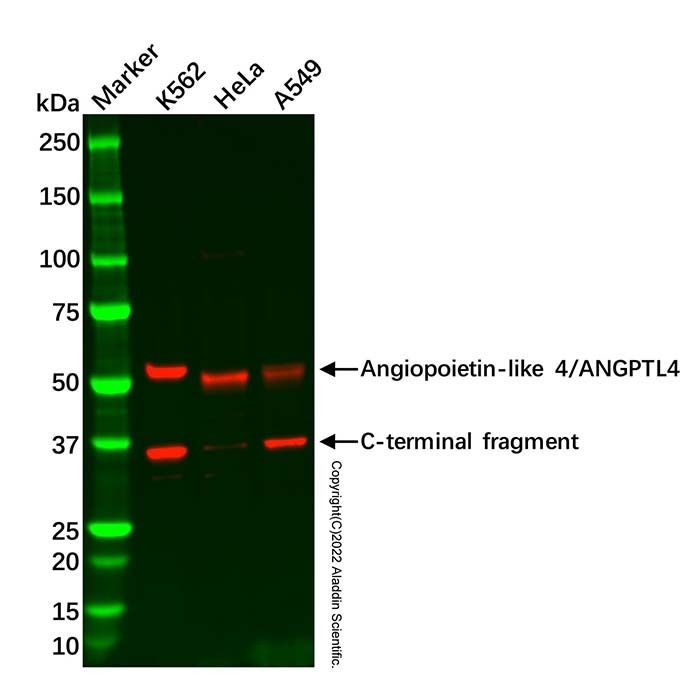 Recombinant Angiopoietin-like 4/ANGPTL4 Antibody -    by Aladdin Scientific