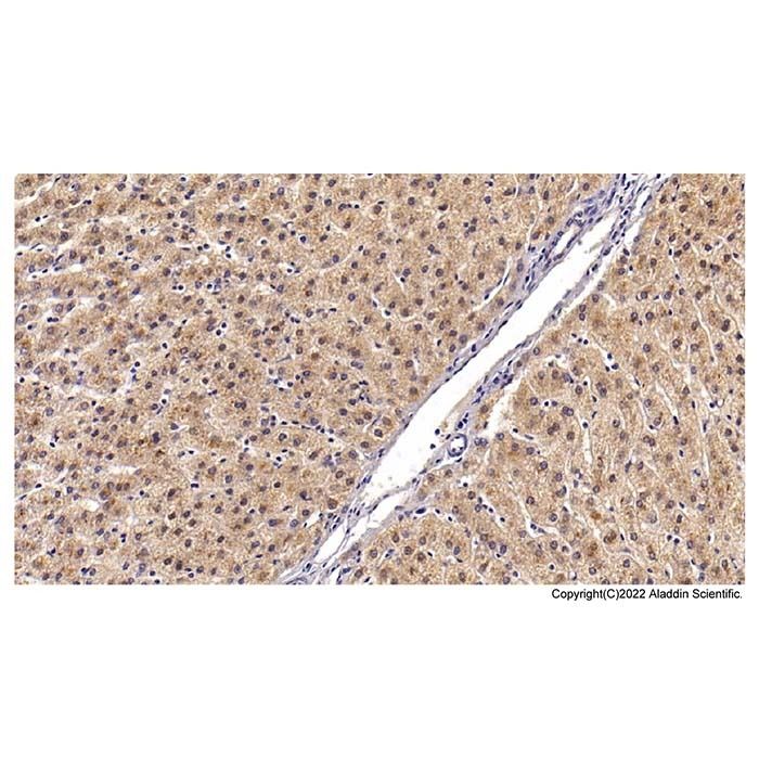 Angiostatin Mouse mAb - by Aladdin Scientific