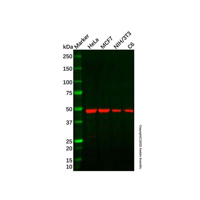 Recombinant Angiotensin II Type 1 Antibody -    by Aladdin Scientific