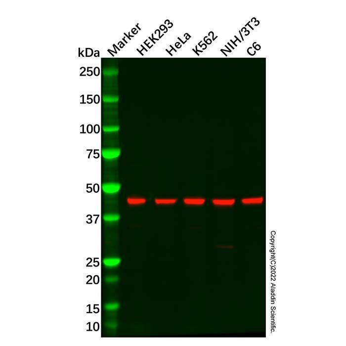 Recombinant AP3M1 Antibody -    by Aladdin Scientific