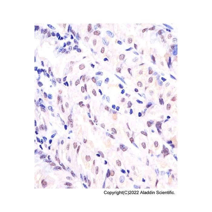 APE1 Mouse mAb -    by Aladdin Scientific
