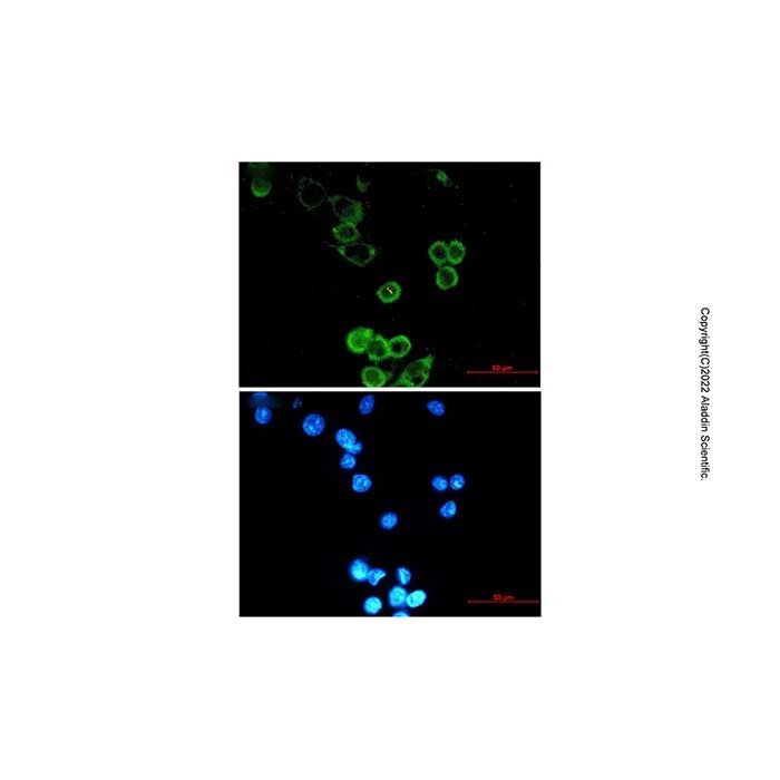 Recombinant APG5L/ATG5 Antibody -    by Aladdin Scientific