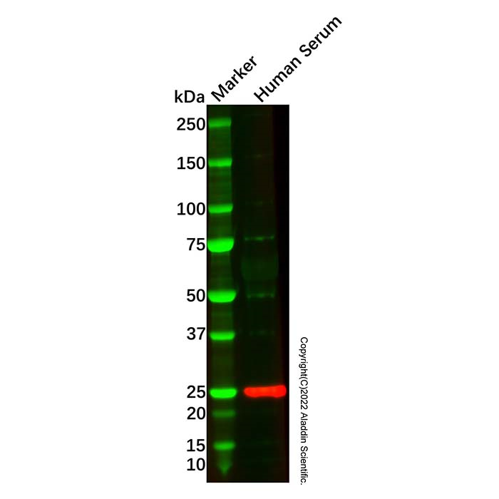 Recombinant Apolipoprotein A I Antibody -    by Aladdin Scientific