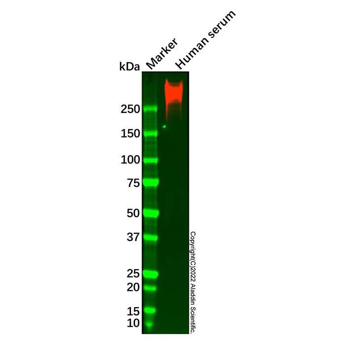 Apolipoprotein B Mouse mAb -    by Aladdin Scientific
