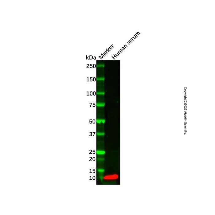 Recombinant Apolipoprotein CI/Apo-CI Antibody -    by Aladdin Scientific