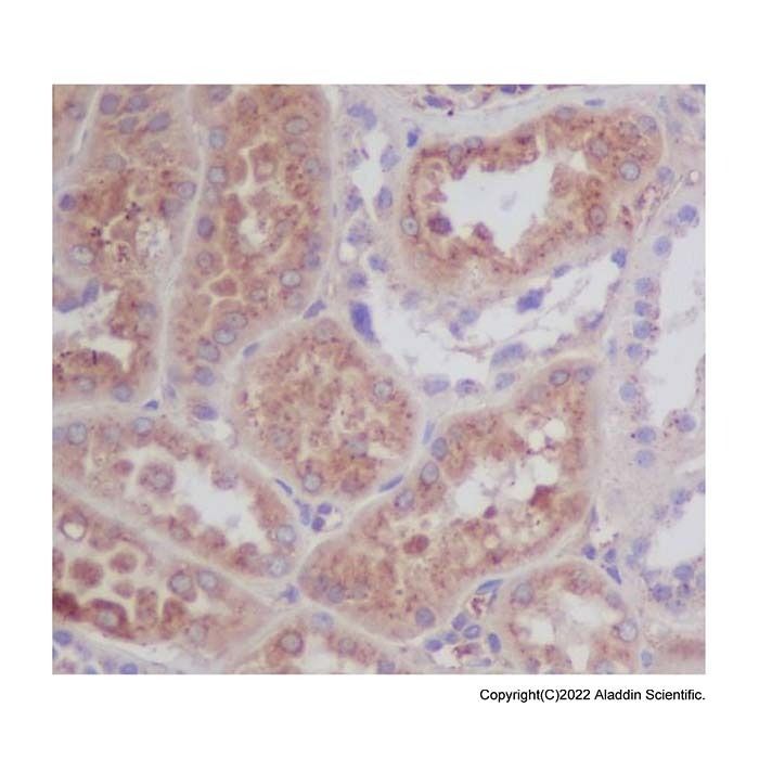 Recombinant Apolipoprotein E Antibody -    by Aladdin Scientific