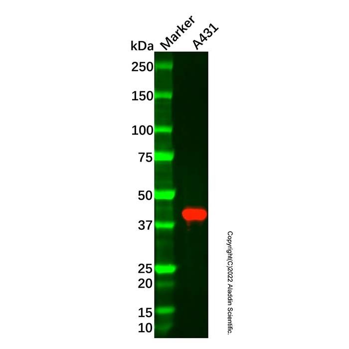 Recombinant Apolipoprotein L1/APOL1 Antibody -    by Aladdin Scientific