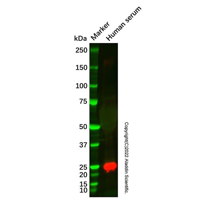 Recombinant ApoM Antibody -    by Aladdin Scientific