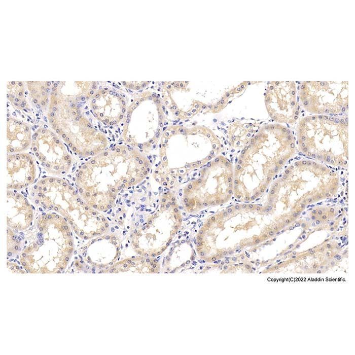 Arg2 Mouse mAb -    by Aladdin Scientific