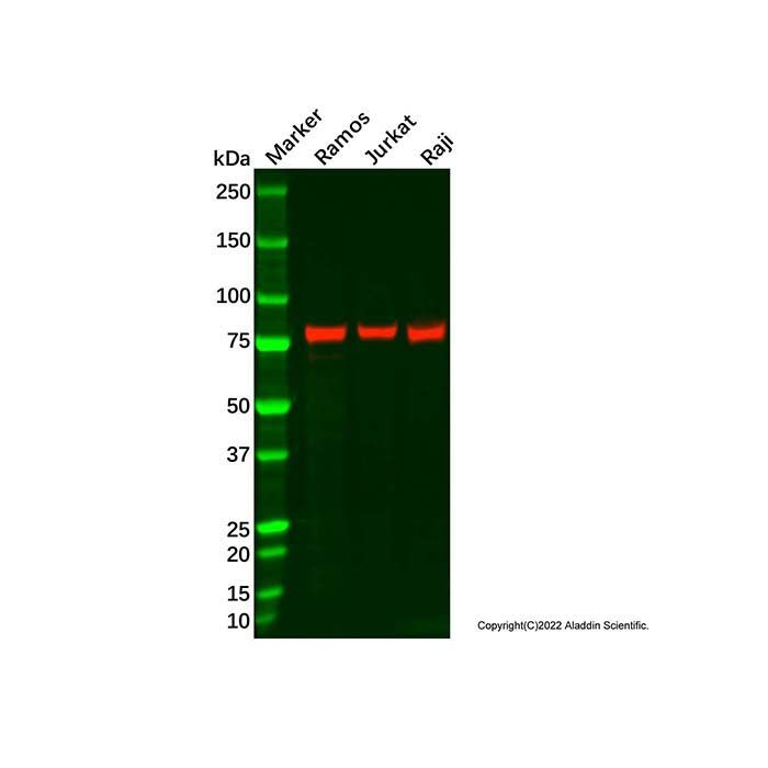 Recombinant ARHGAP25 Antibody -    by Aladdin Scientific