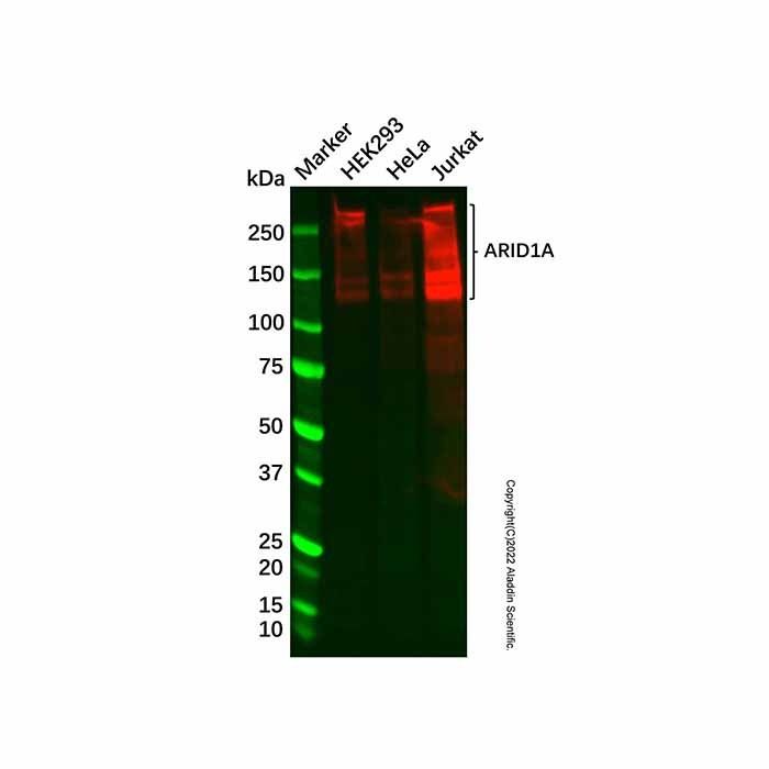 Recombinant ARID1A Antibody -    by Aladdin Scientific