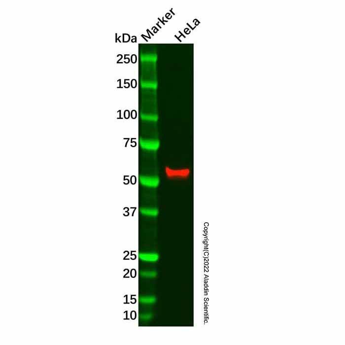 Recombinant Aromatase Antibody -    by Aladdin Scientific