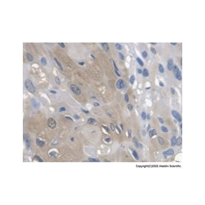 ARSA/ASA Antibody -    by Aladdin Scientific