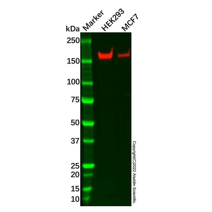Recombinant AS160 Antibody -    by Aladdin Scientific