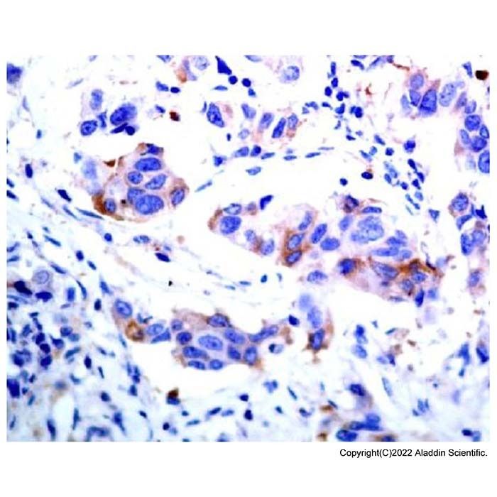 ASK1 Antibody -    by Aladdin Scientific
