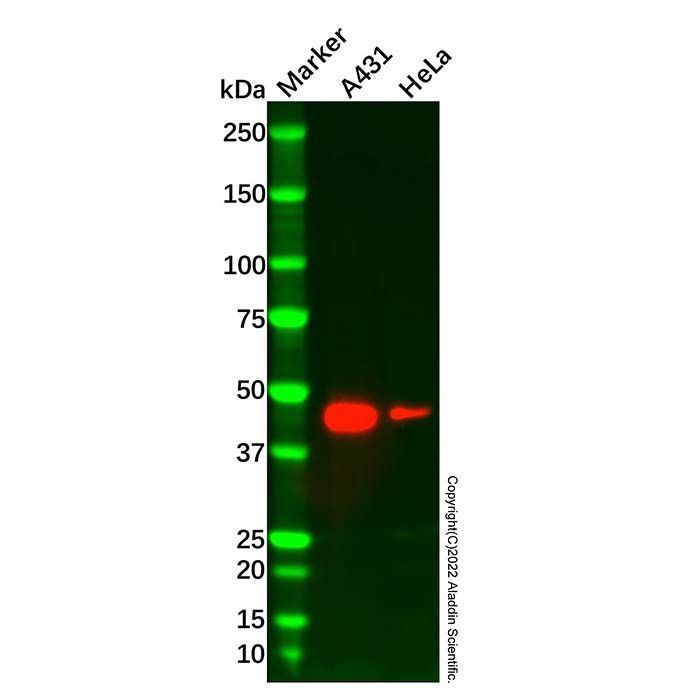 Recombinant ASS1 Antibody -    by Aladdin Scientific