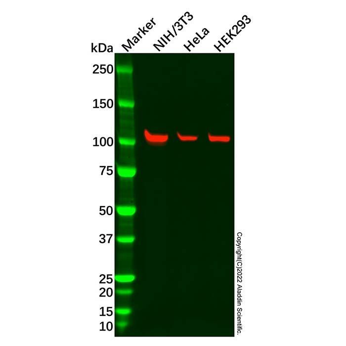 Recombinant Ataxin 1 Antibody -    by Aladdin Scientific