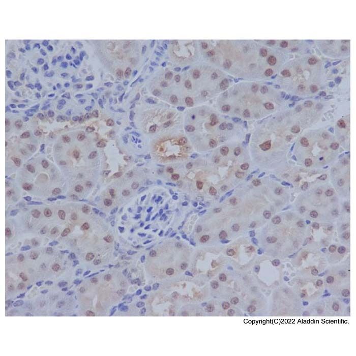 ATF-4 Antibody -    by Aladdin Scientific